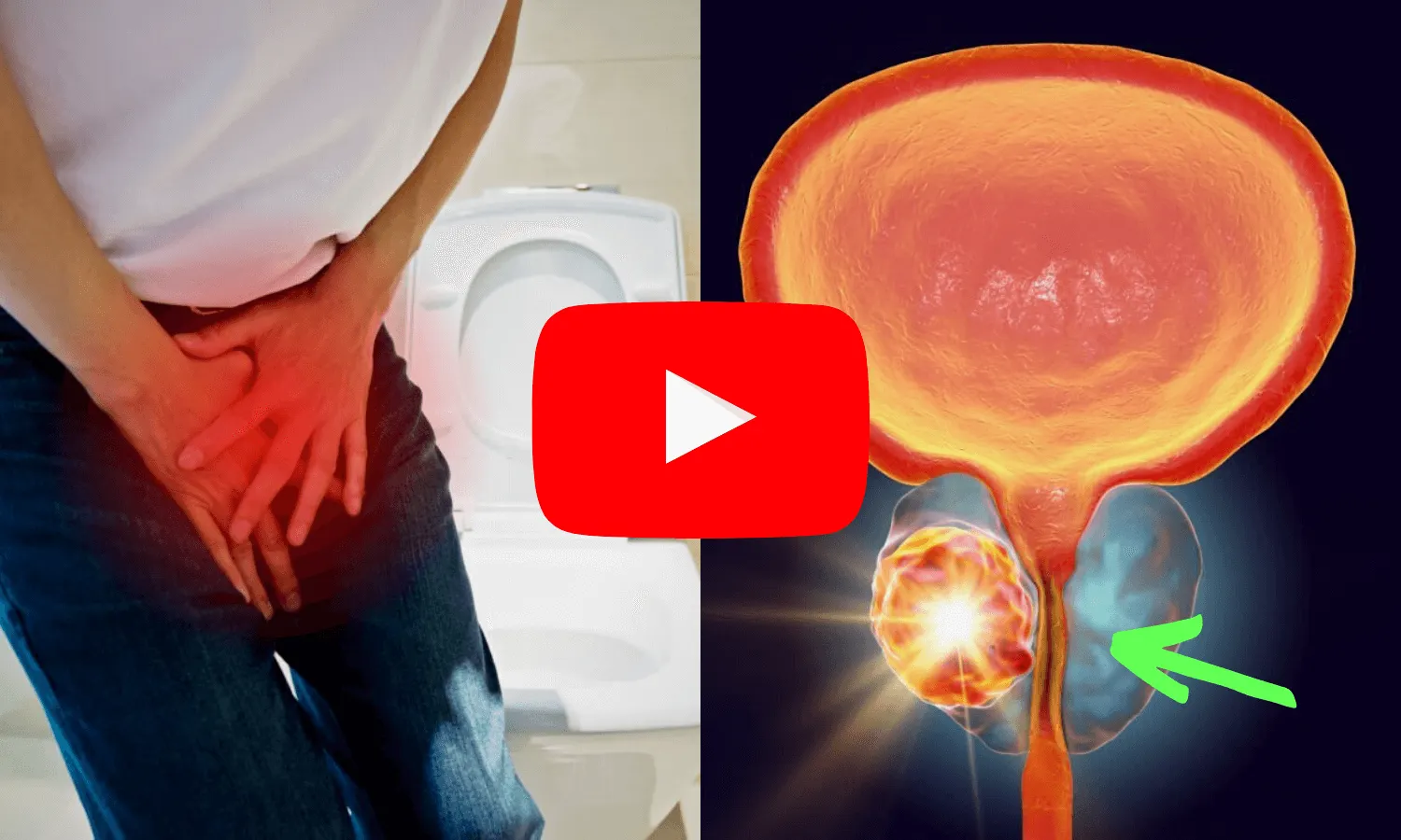 Prostate Inflammation Solution